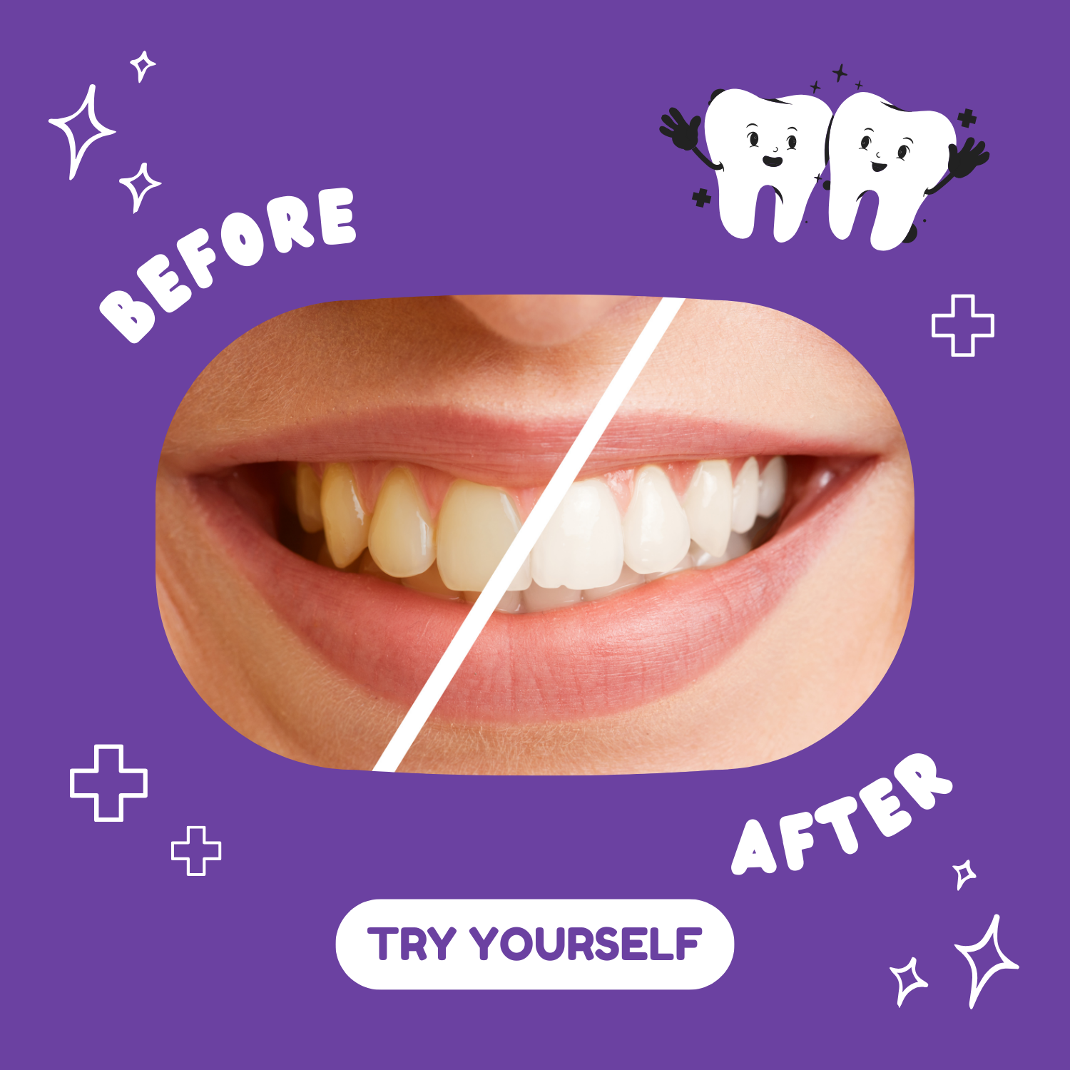 WTOTG™ Teeth Whitening Pen